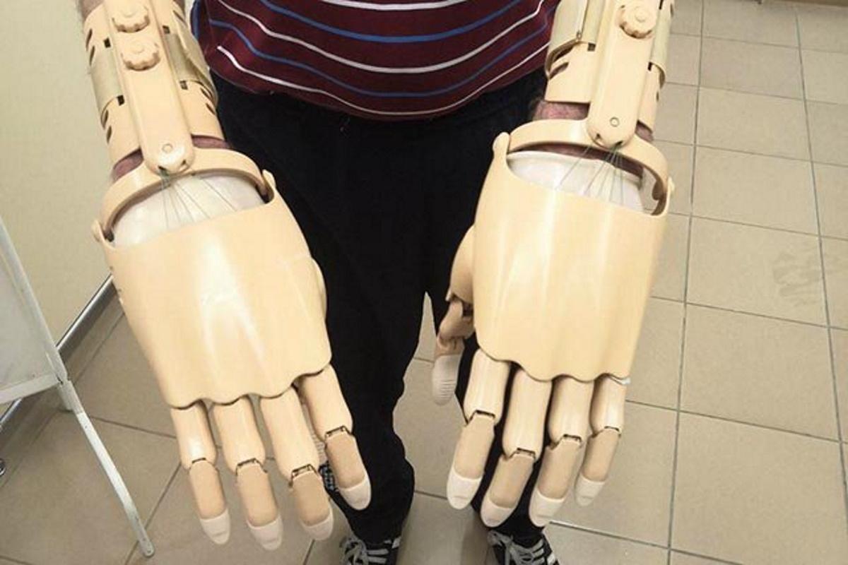 Студенты майкопского вуза создали доступный по цене тяговый протез кисти руки