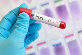 Swine flu: alarming rumor or real threat?