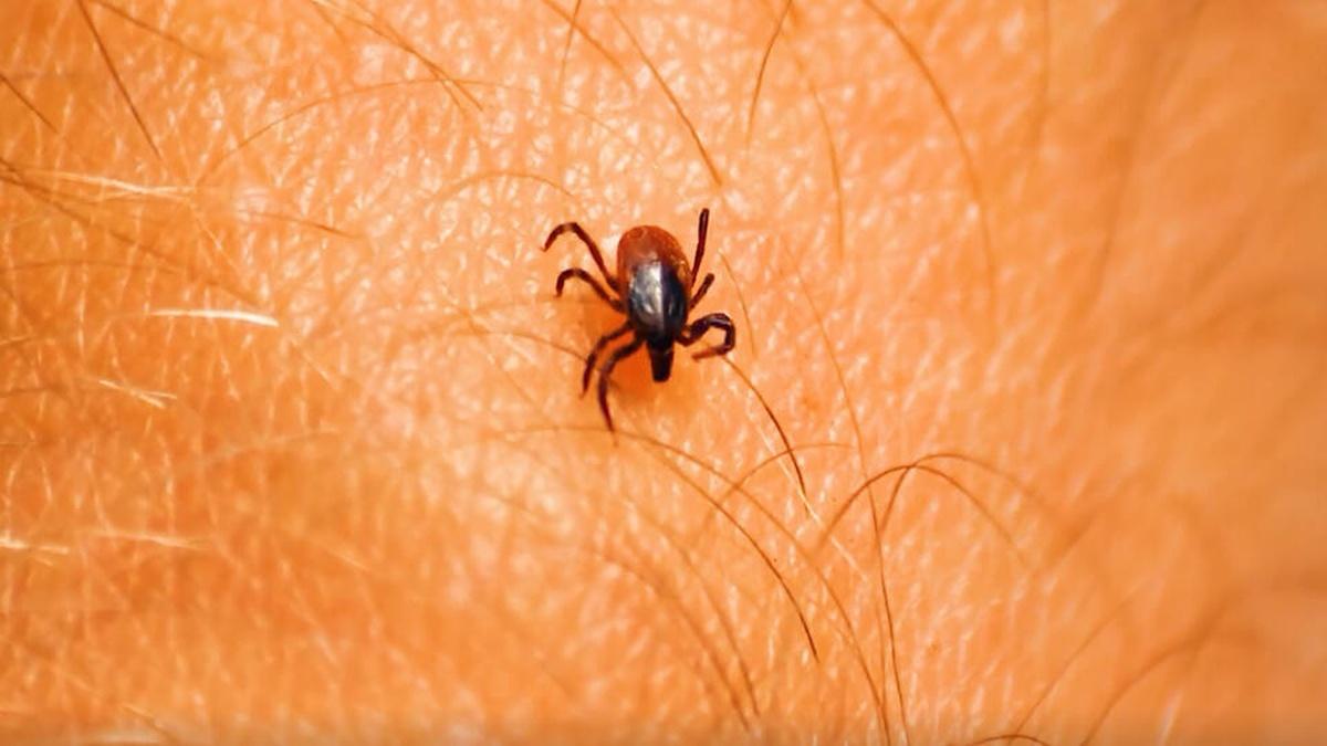 Клещи могут стать причиной заражения жителей Павловского Посада гранулоцитарным анаплазмозом