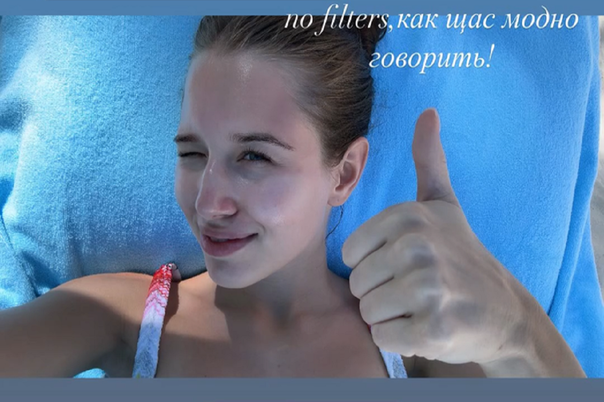 Без фильтров: Аврора Киба показала, как выглядела до ринопластики