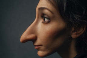 Точка перезапуска жизни: как ринопластика может помочь человеку стать увереннее?