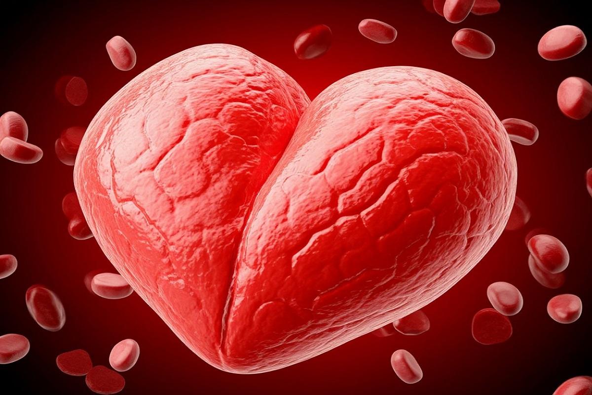 Врач развенчивает заблуждения о «плохом» холестерине