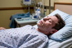 Американец привез оспу обезьян в Молдавию: турист заразился в США и попал в инфекционную больницу Кишинева