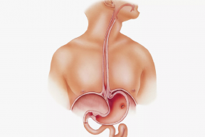 Семь вопросов о грыже пищевода: отвечает врач-гастроэнтеролог Милана Халиль