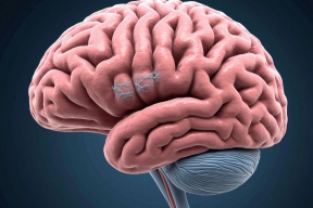 В Новосибирске нашли способ подавлять агрессивную опухоль мозга