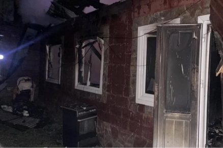 Стало известно о состоянии пострадавших в пожаре детей в Ингушетии