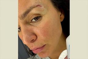 Zivert без фильтров: певица показала шрам от йоги и призналась в седине