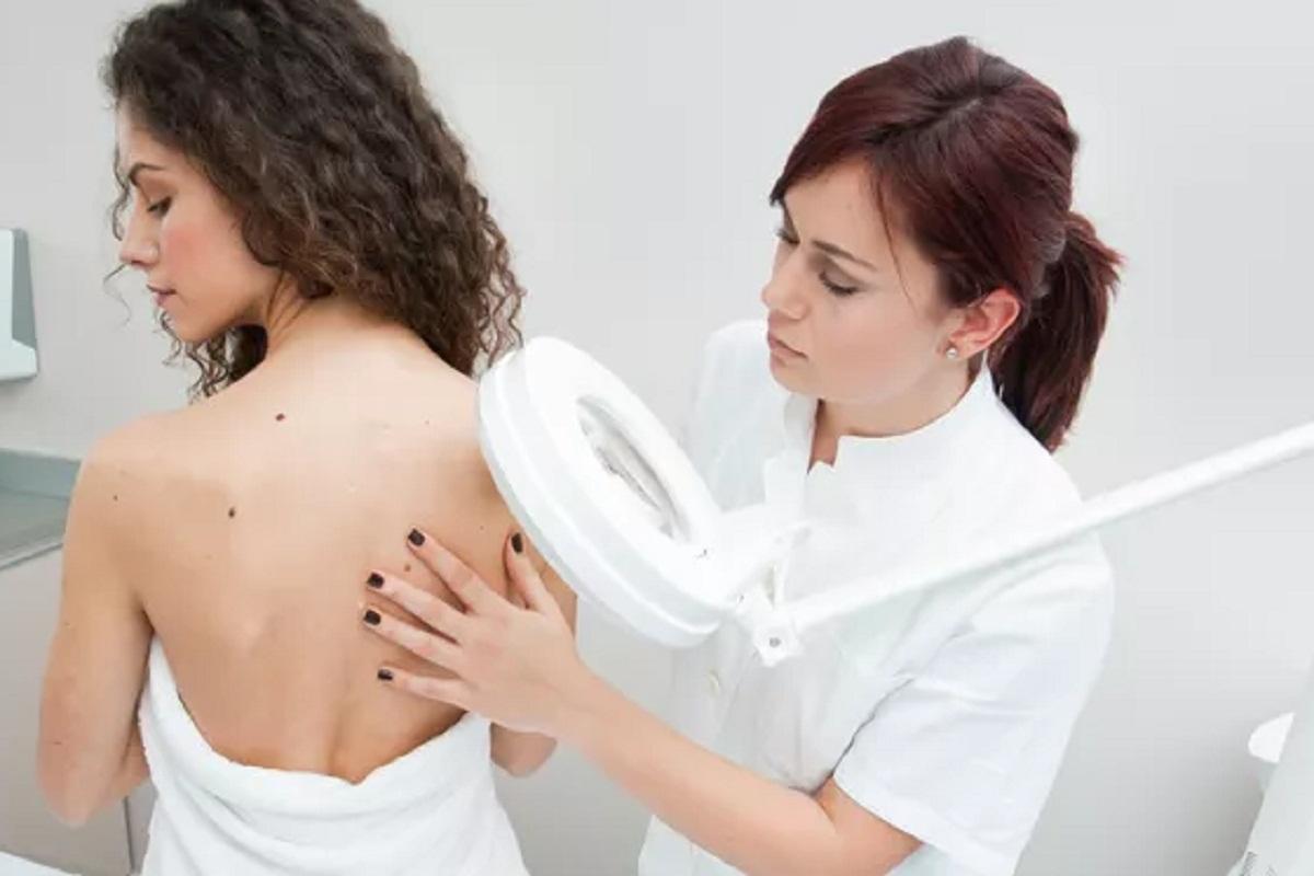 Врач Черемушкин: Меланома поддается лечению при обнаружении на ранней стадии